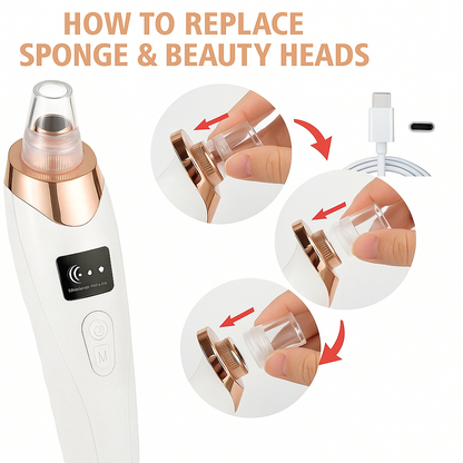 UBA™ – Electric Acne Pore Cleaner &amp; Blackhead Remover